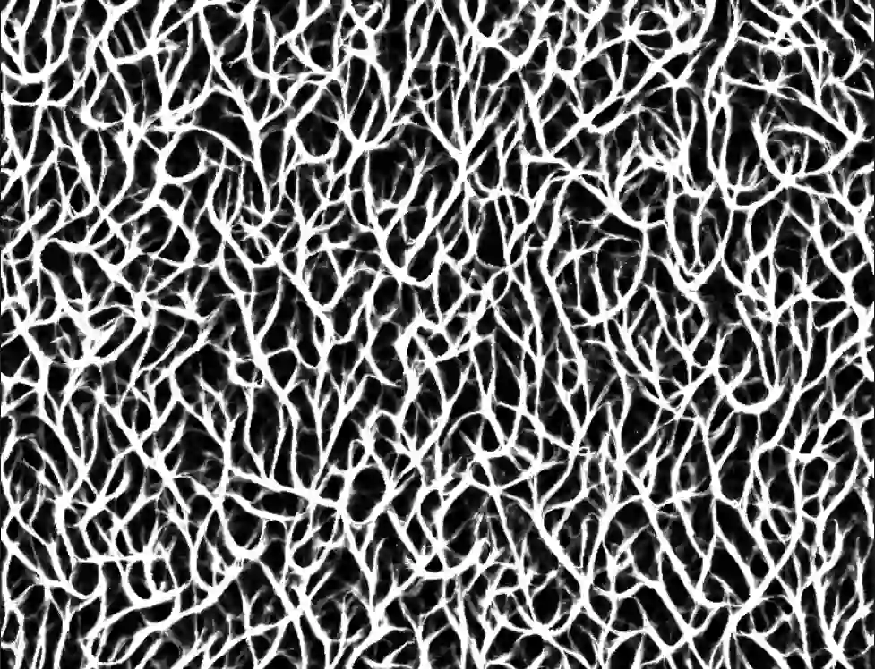 white slime mold simulation creating a pattern of densely interlocking branches